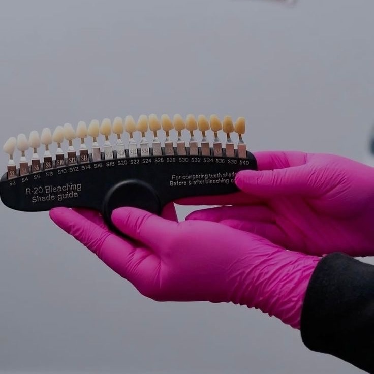 Cosmetic Teeth Whitening at Sparkle Smile Spa LLC in Chandler, AZ