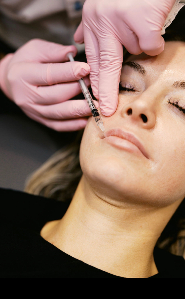 Dermal Filler Treatment