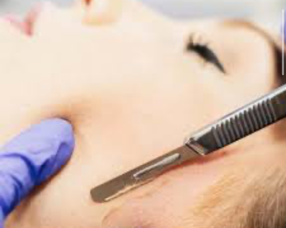 Dermaplane Special