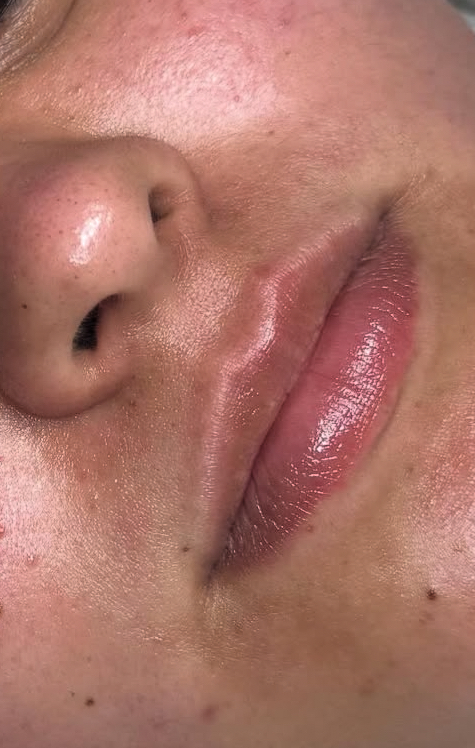 Chin + Lip Wax