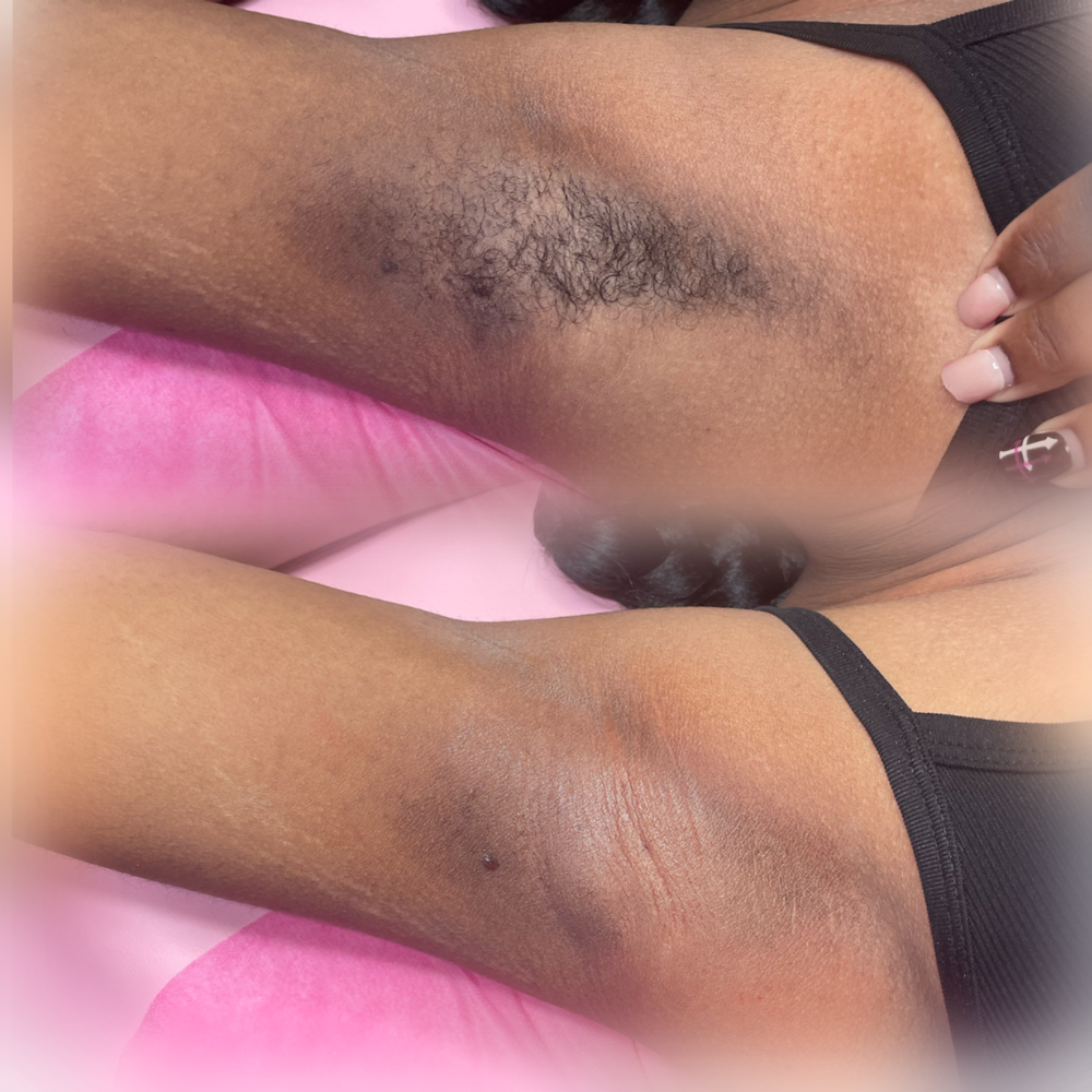 Underarms