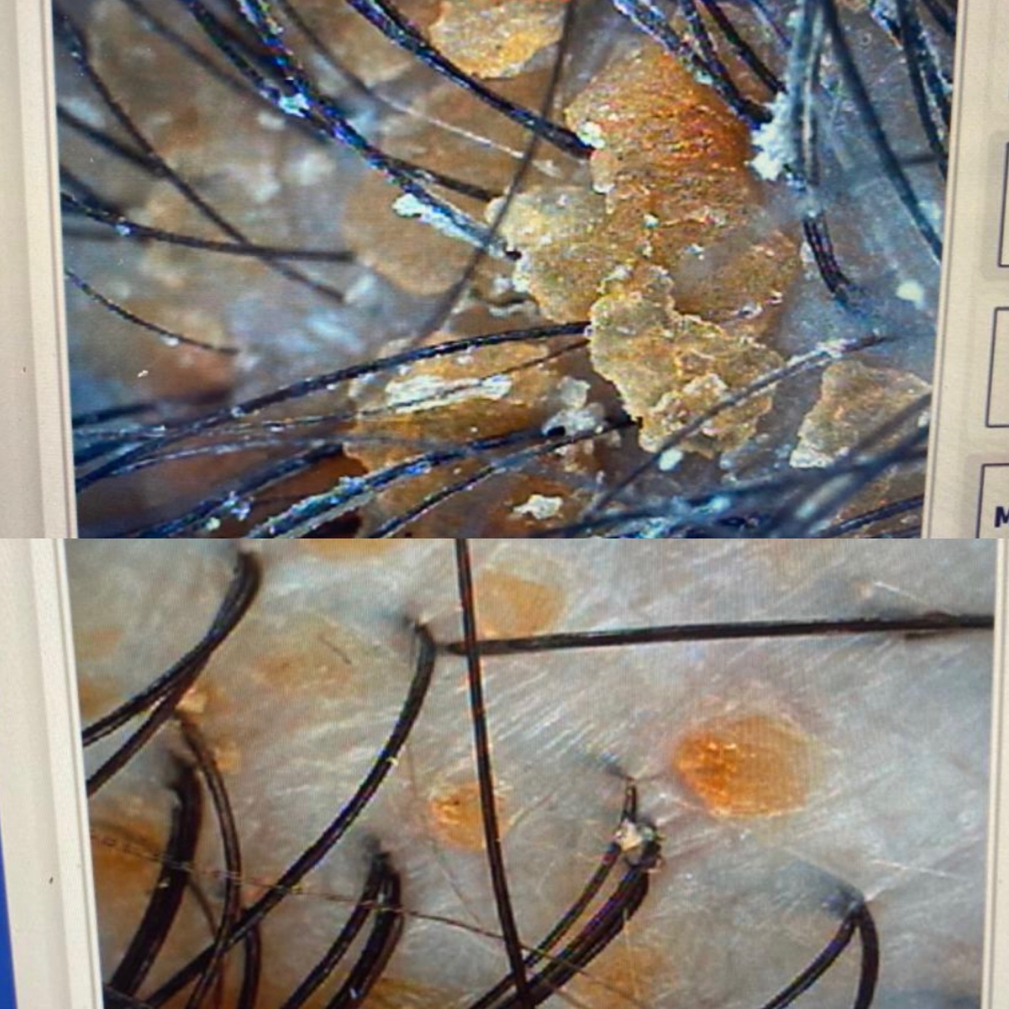 Botanical Scalp Treatment ROST