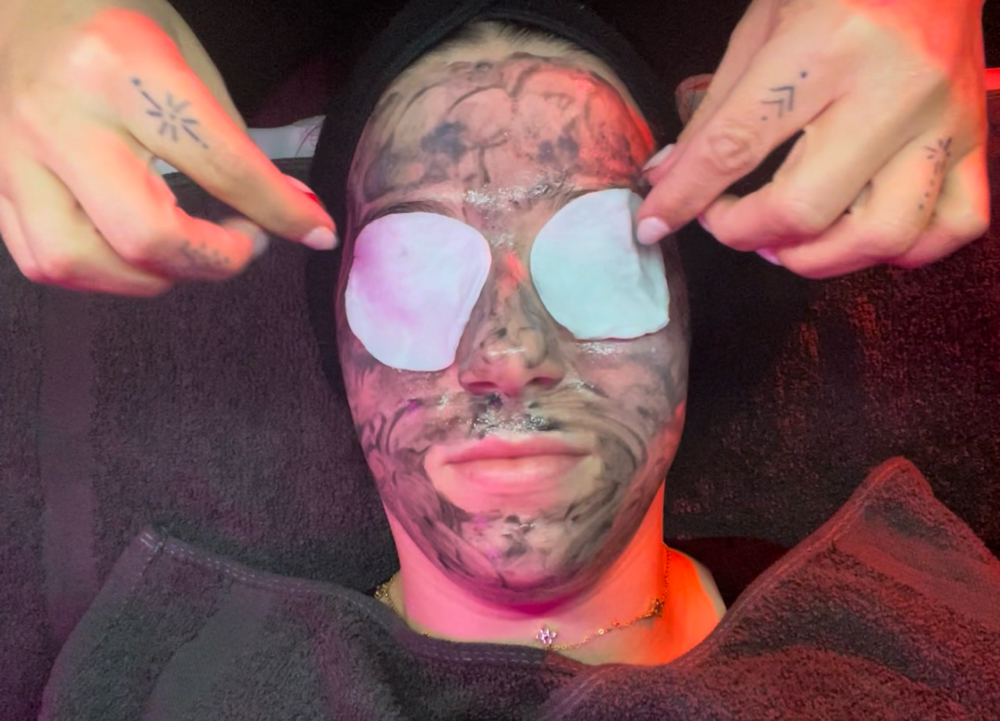 Acne Facial