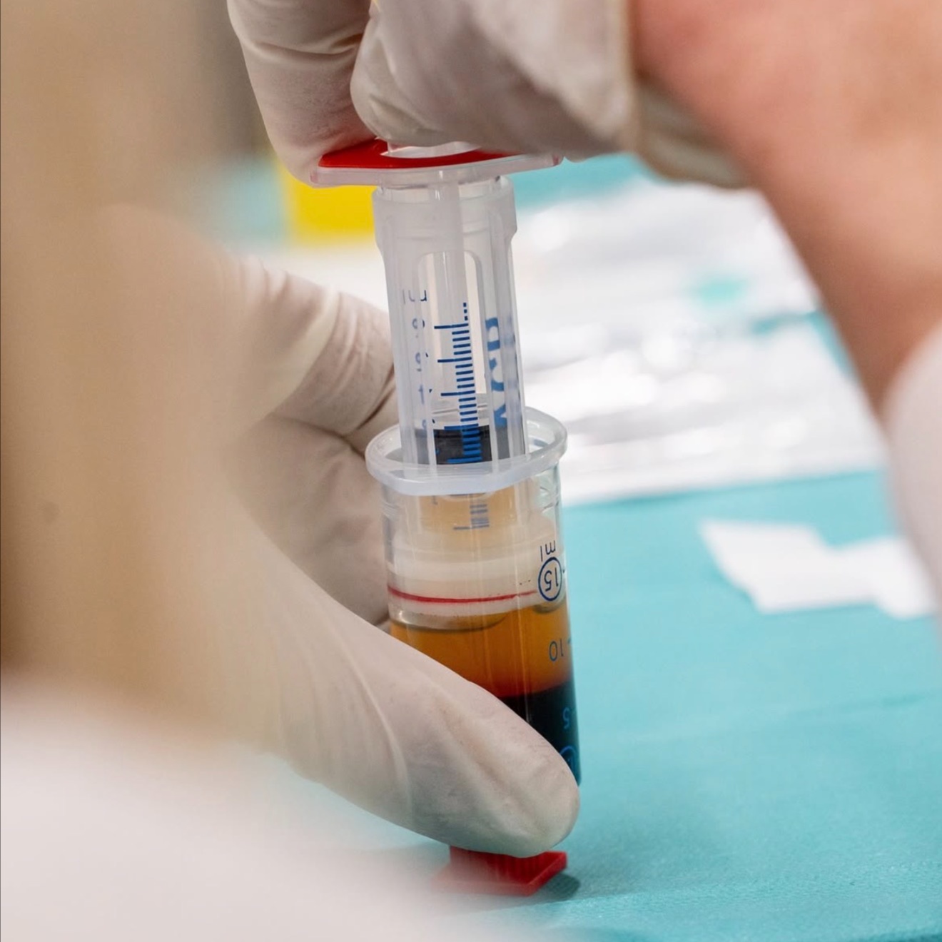 Arthrex PRP Skin Regeneration