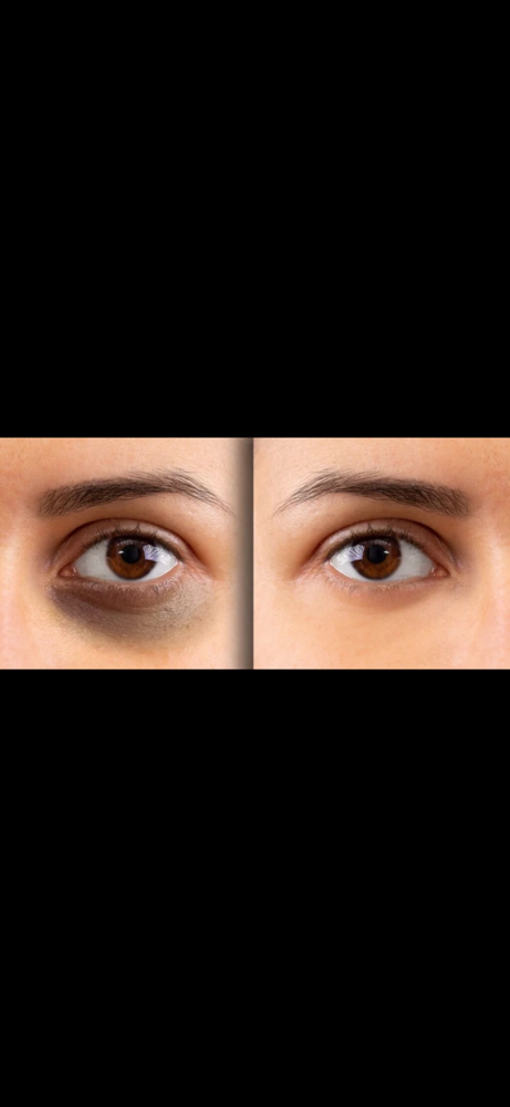 Santi Eyes - Undereye Treatment