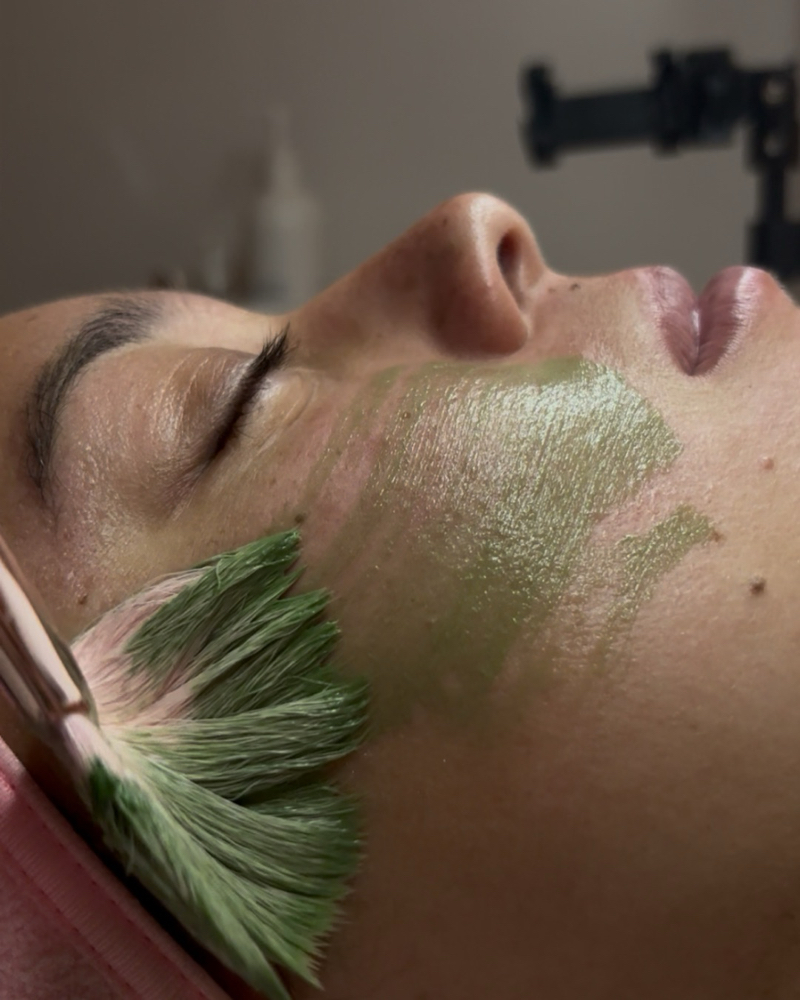 Acne Facial Treatment