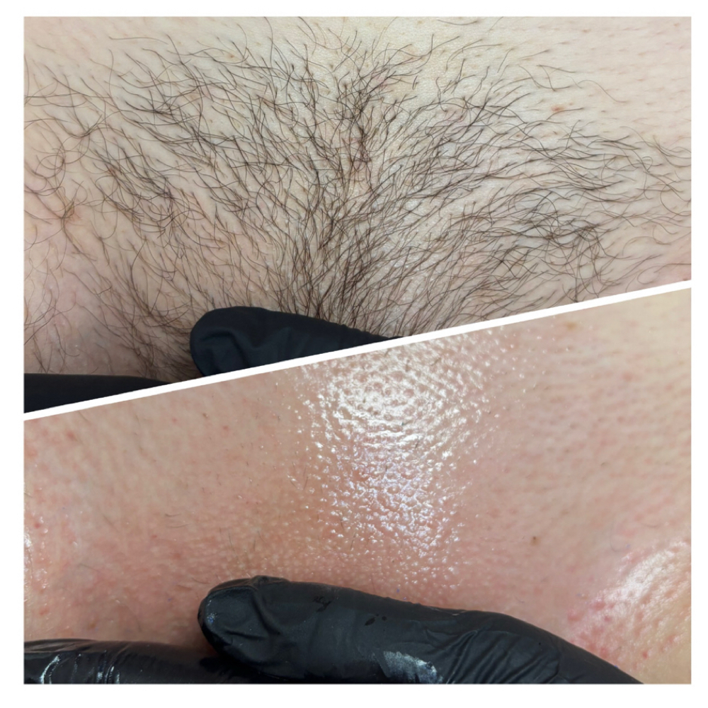 Brazilian Wax - First Time Client at Beauty By Randi in Farmington, MI