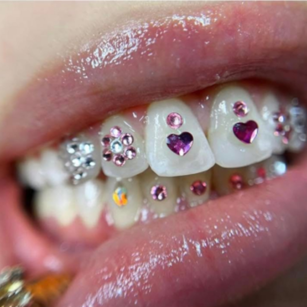 Tooth Bling ( Extra Stone)