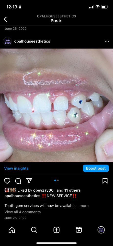 Tooth Gem