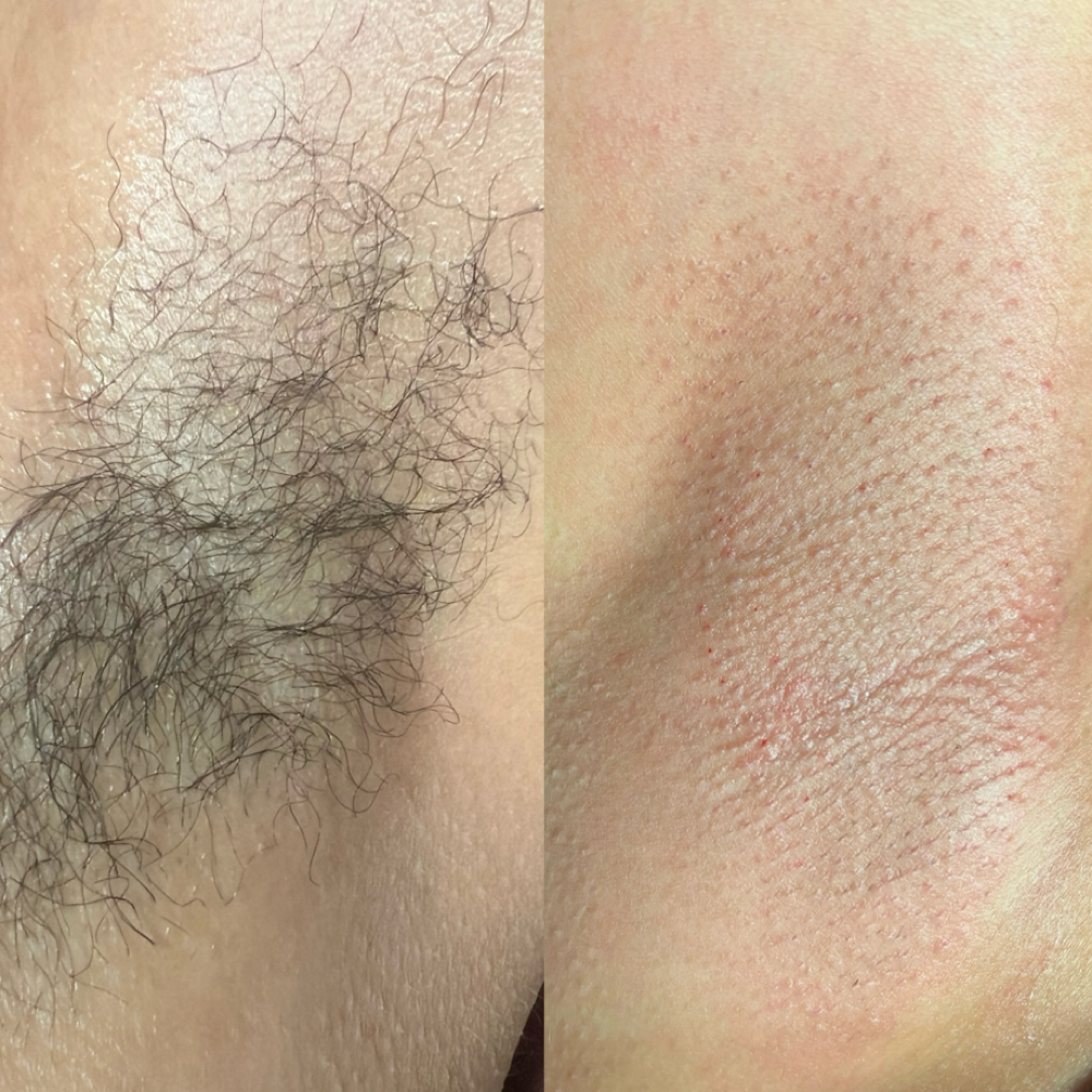 Underarm Wax at Hoosier Beauties in Bloomington, IN