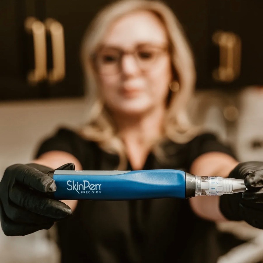 Microneedling with PRP