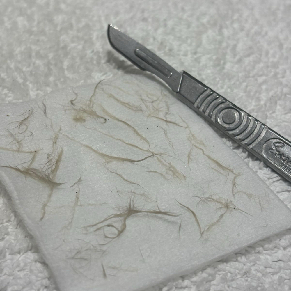 The Mini Dermaplaning Facial(40Min) at Encore Esthetics in Covington, GA