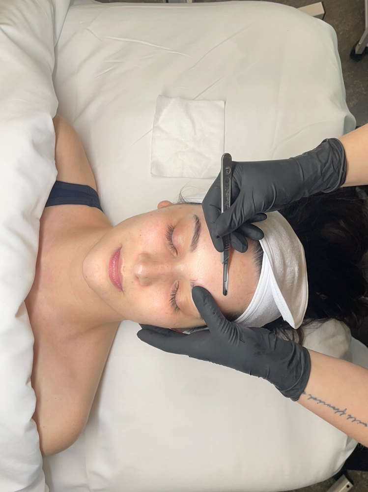 Dermaplane & Light Peel