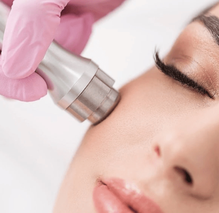 Microdermabrasion Add On