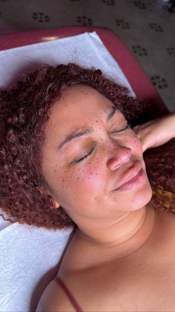 Tattooed Freckles