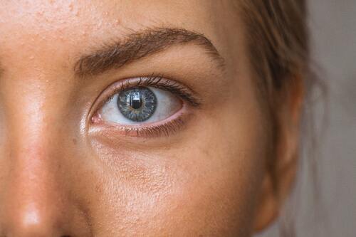 Acne Holistic Facial