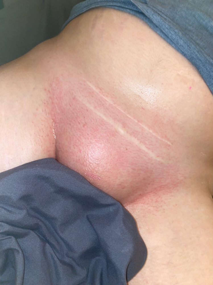 Brazillian Wax at Esthetic’s By Chelsie in Port Arthur, TX