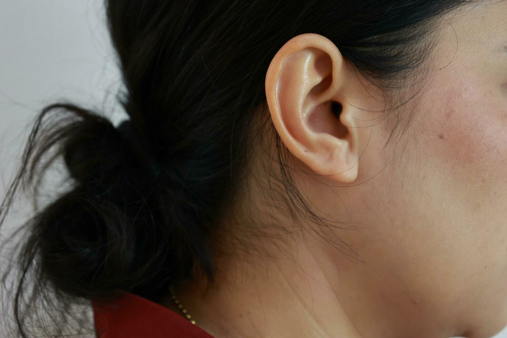 Ear Hair Wax