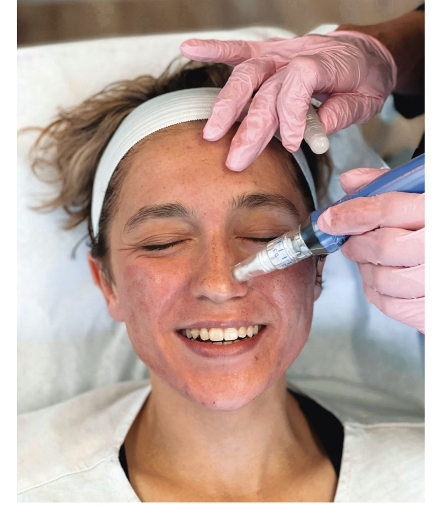 💎UltimateRenewalPackage(6Sessions) at Danae Glow Wellness | Amatherapy in Annandale, VA