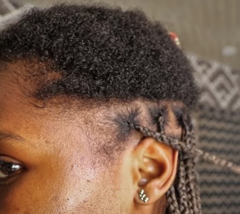 Low Density Hair