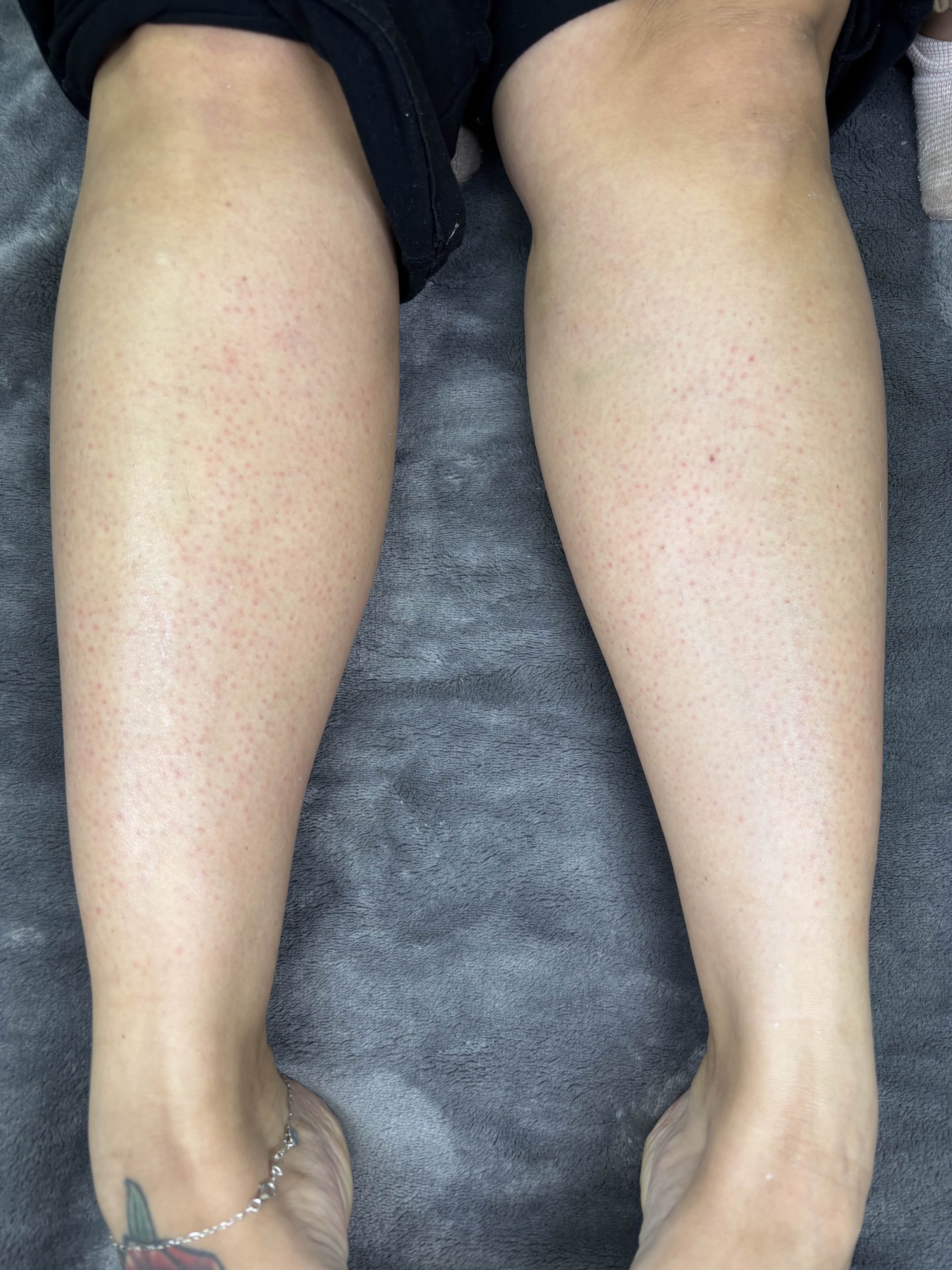 Half Leg Wax