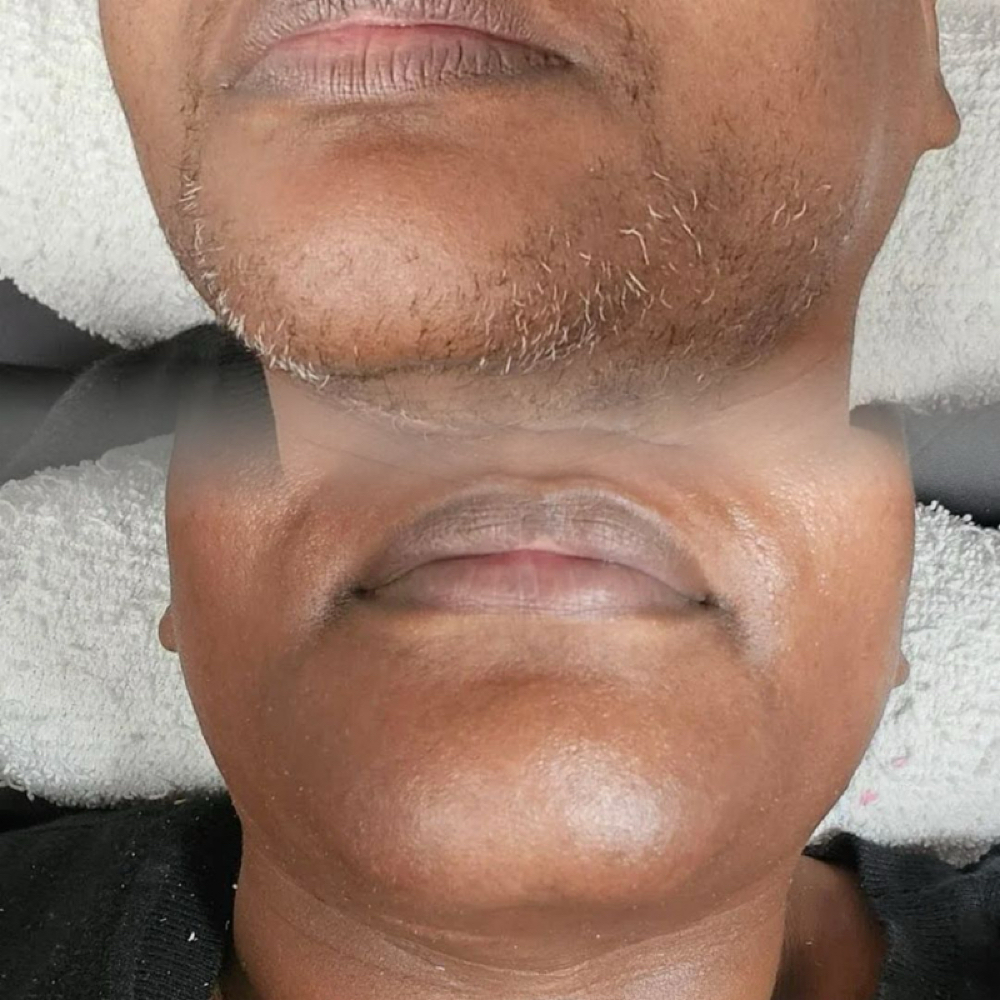 Lower Face Wax at The Mobile Spa in Rochester, NY