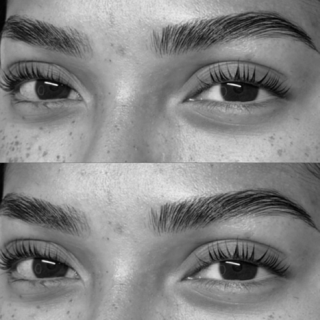 THE FULL FRAME at Cozmo Esthetics in Dallas, TX