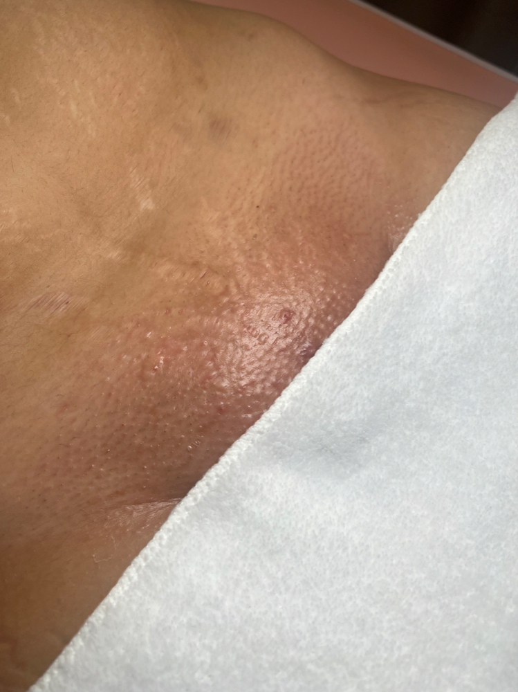 Brazilian Wax