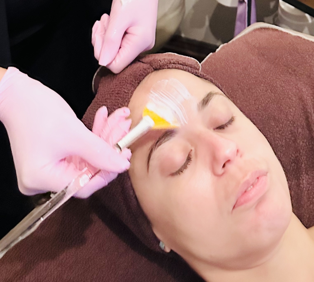 Peel Treatment With Express Facial