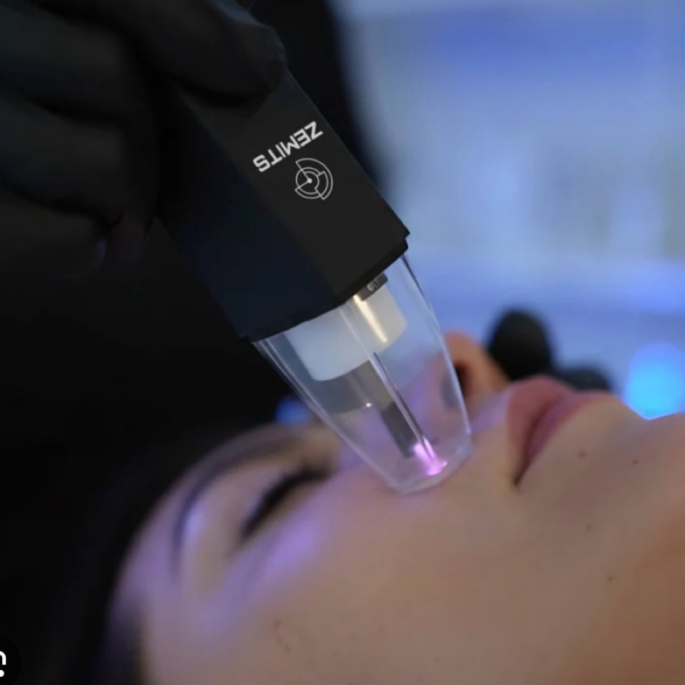EvoPlasm Cold Plasma Add-on at Skin By Thalia in Chicago, IL