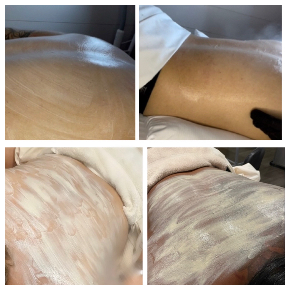 Back Facial/Facial de espalda