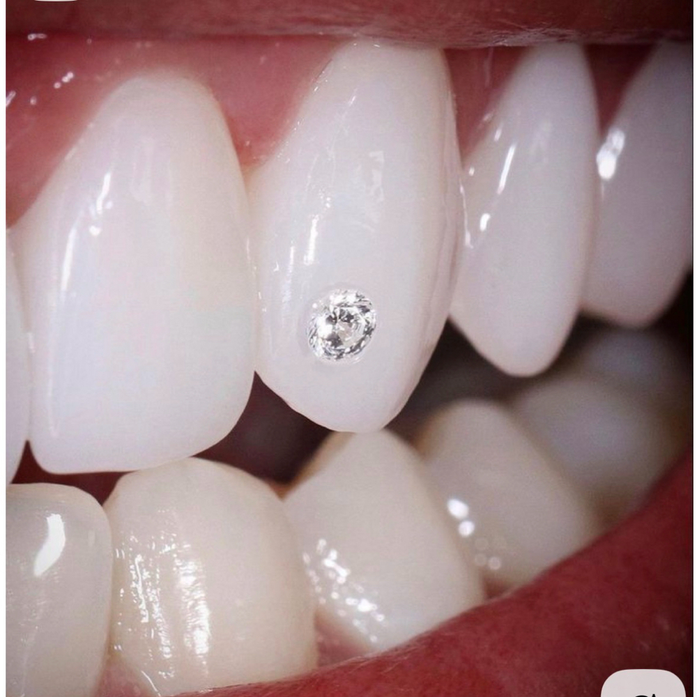 Teeth Gems