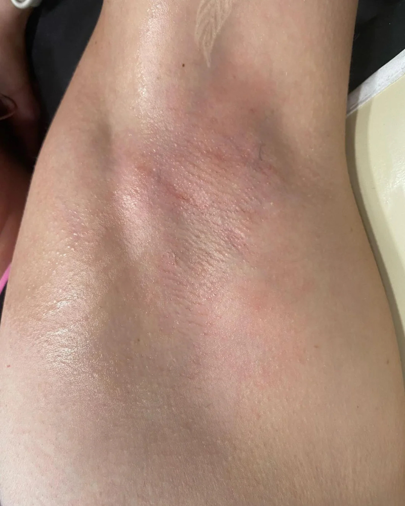 Underarm Waxing