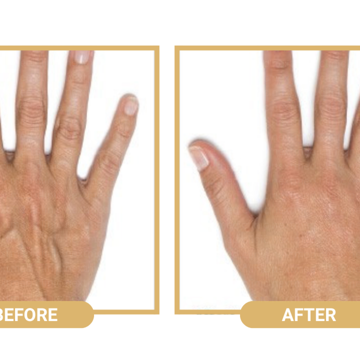 Skin Rejuvenation at Avidan Med Spa in Warwick, NY