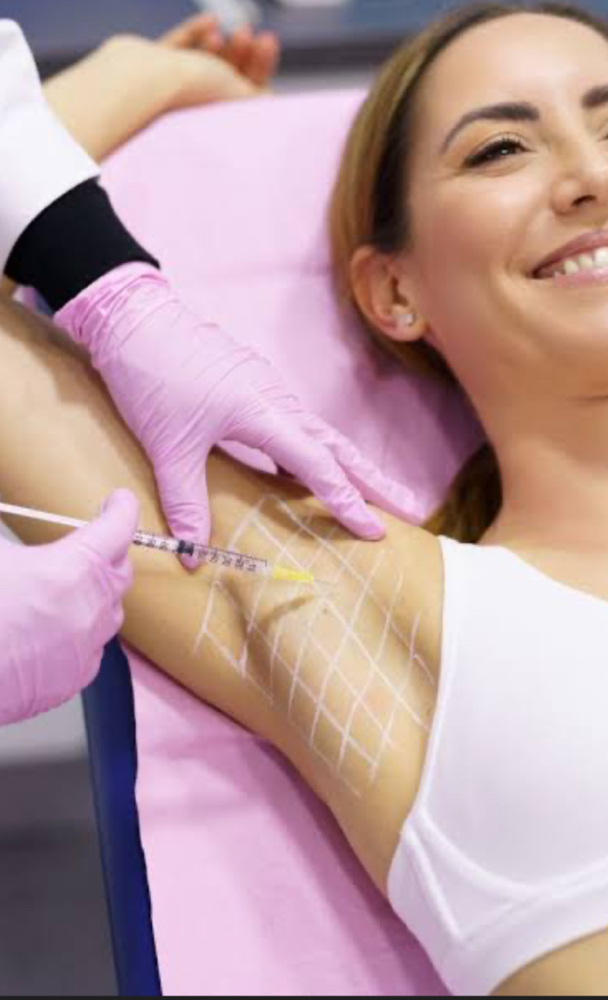Armpit Tox/Controla Sudor De Axilla at Revital Med Aesthetics & Wellness in Oceanside, NY