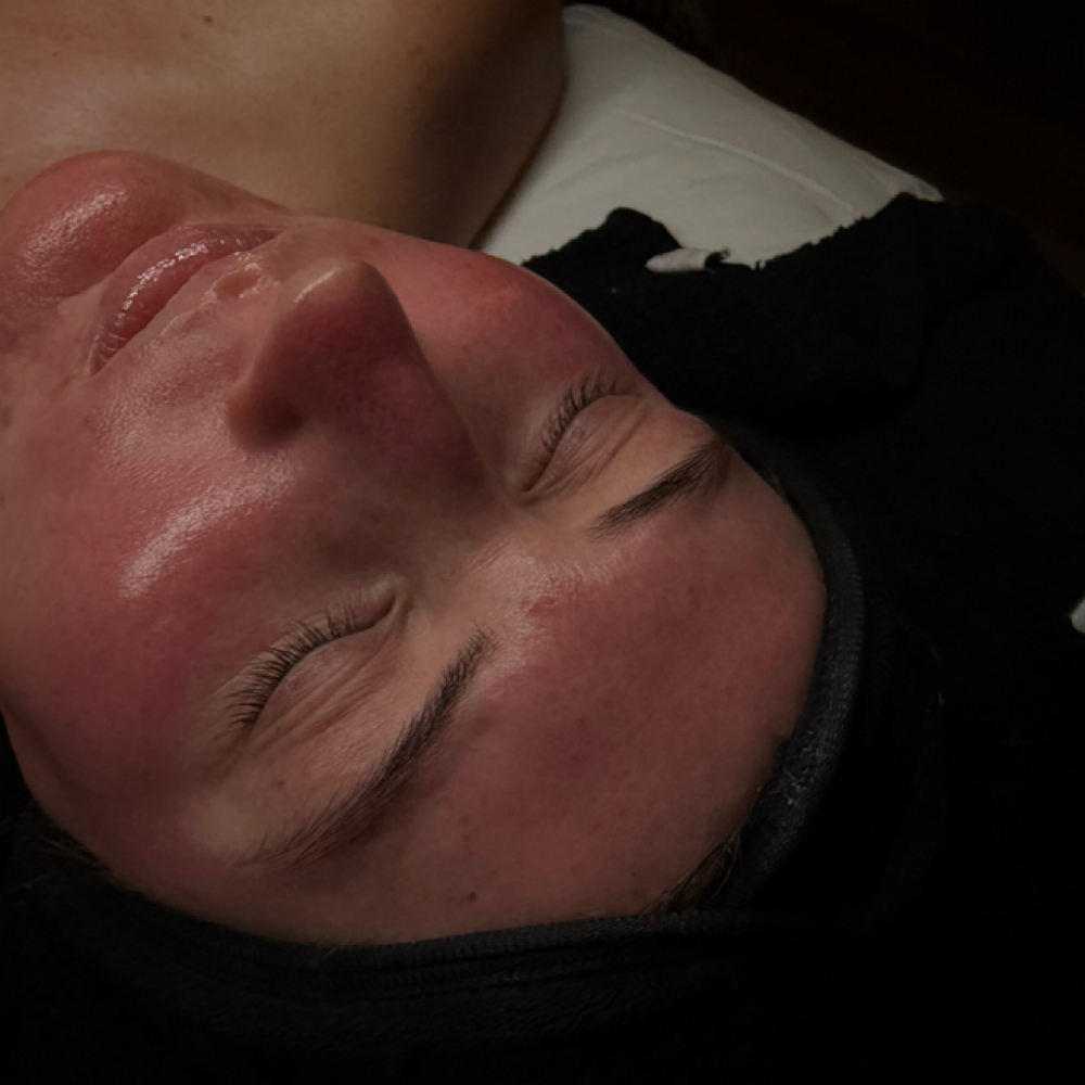 Decongest & Clarify Facial at Reese SkinTreat in Cape Girardeau, MO