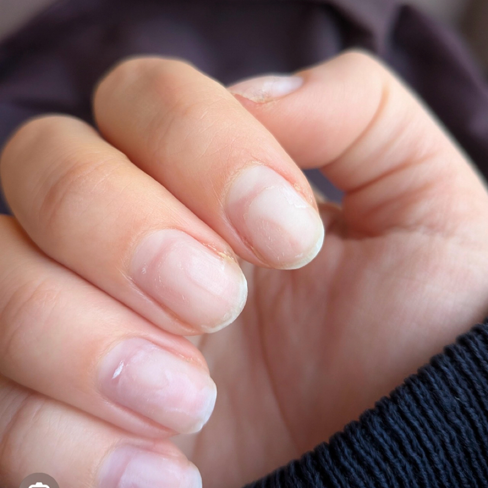 Removal at Faith Filled Nails in Salina, KS