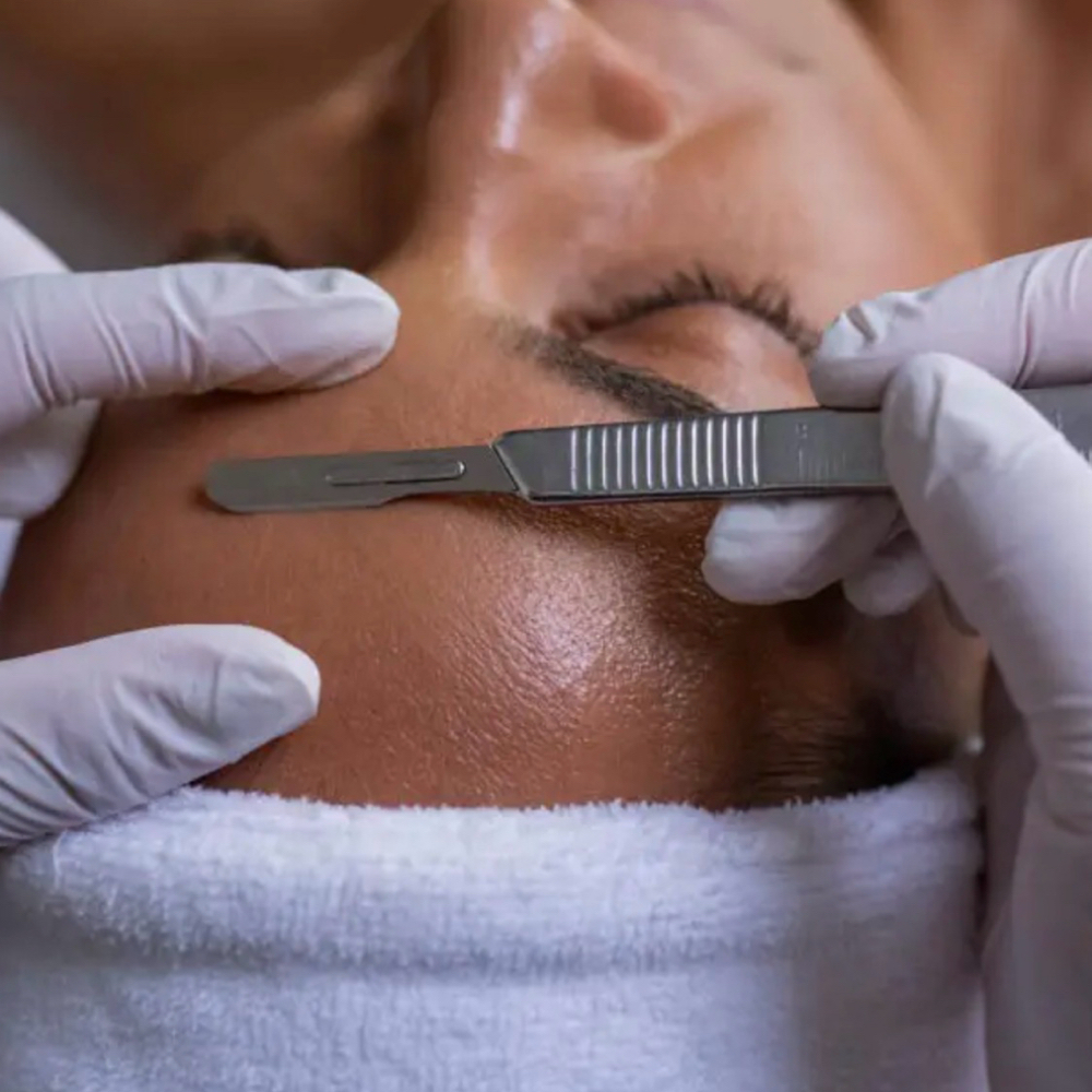 DERMAPLANNING FACIAL at RGV PRIME AESTHETICS PLLC in Mcallen, TX