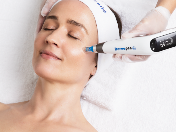 Microneddling + Über Peel Bundle