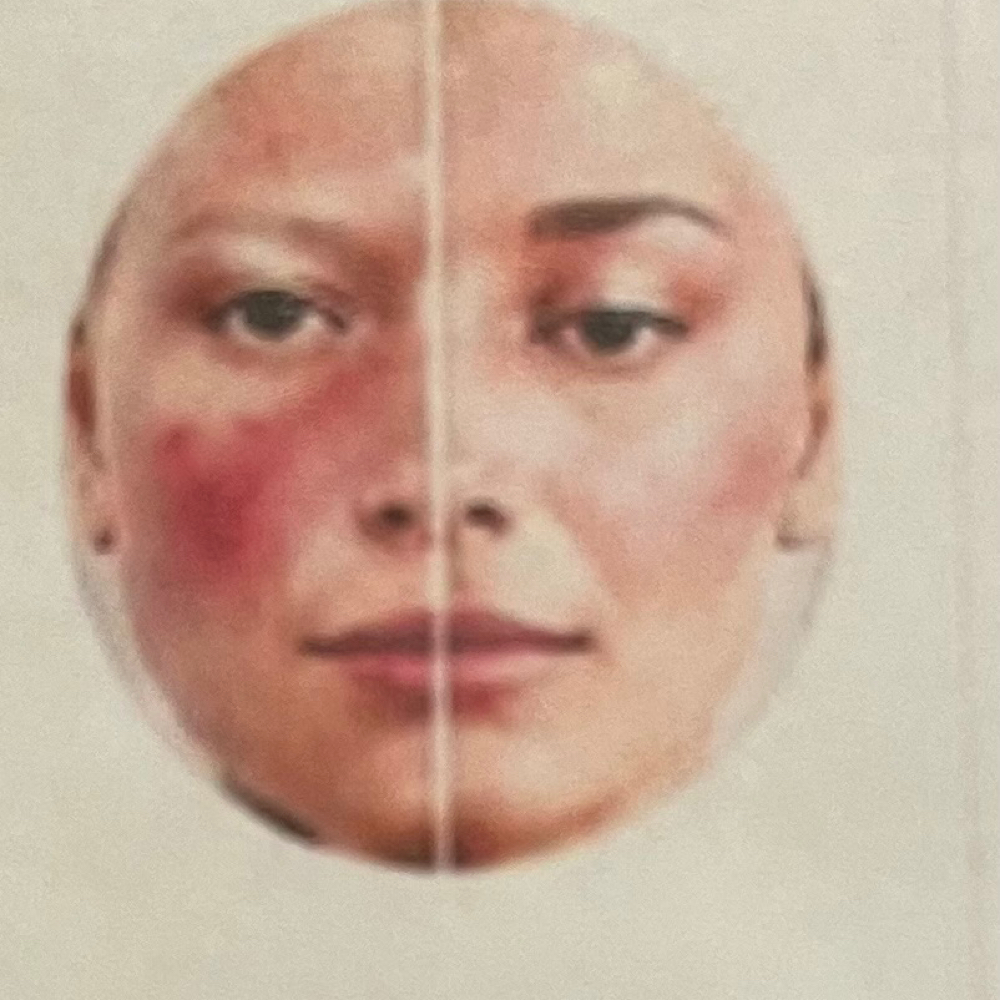 Terapia Balance Skin at Glow by Ely & Mily Beauty Salon in Miami, FL