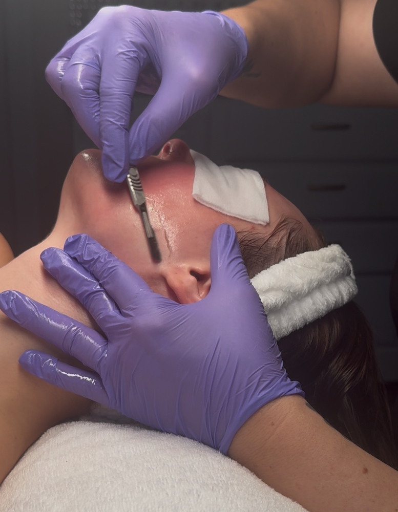 Dermaplaning Facial