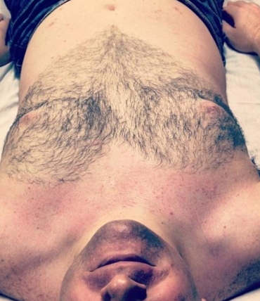 Chest (Male)