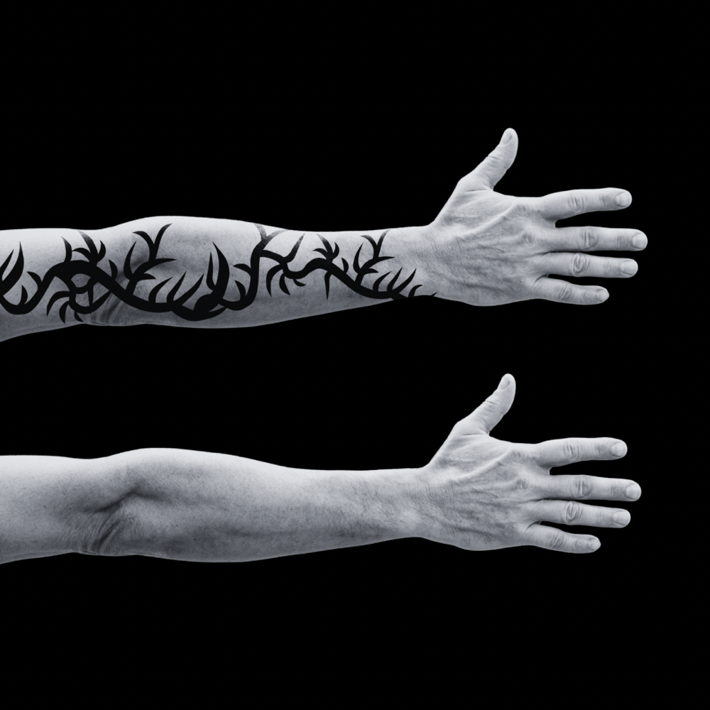 đź’ŽLaser Tattoo Removal