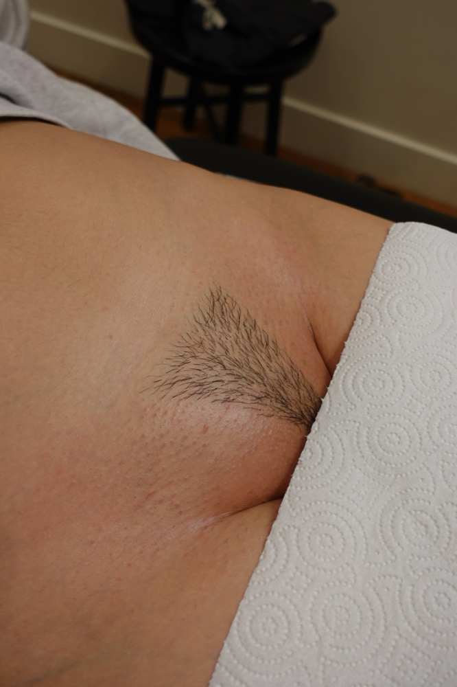Full Bikini Wax