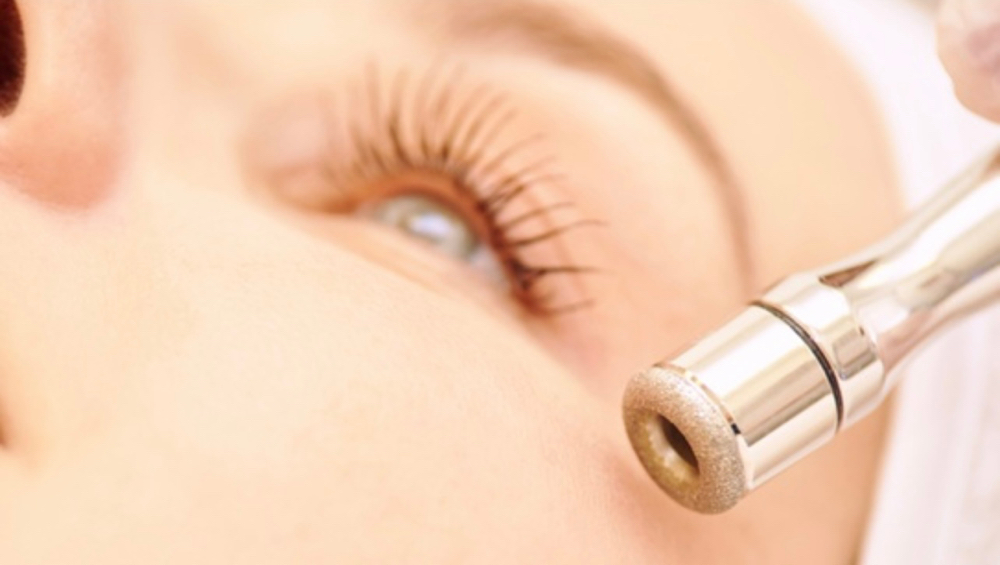 Microdermabrasion + Facial