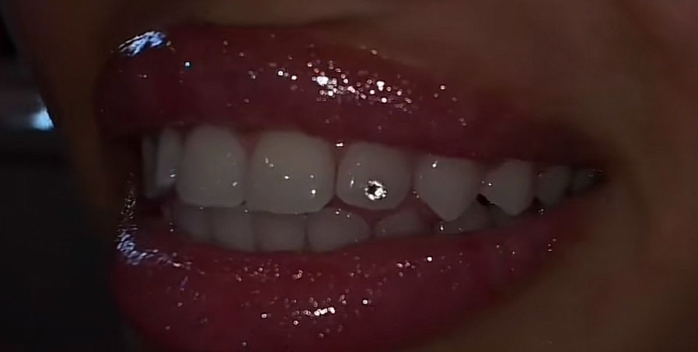 Single Tooth Gem