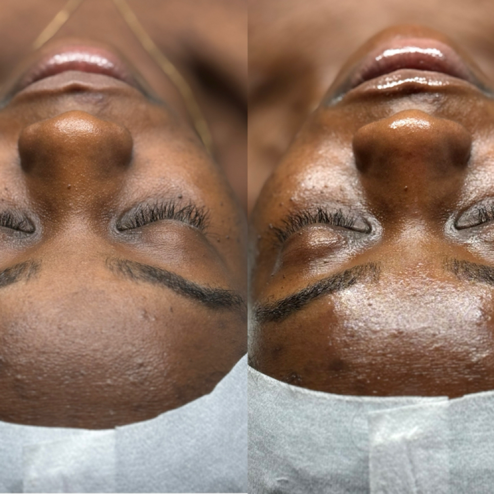Green Sea Peel at Oasiah Aesthetics in New York, NY