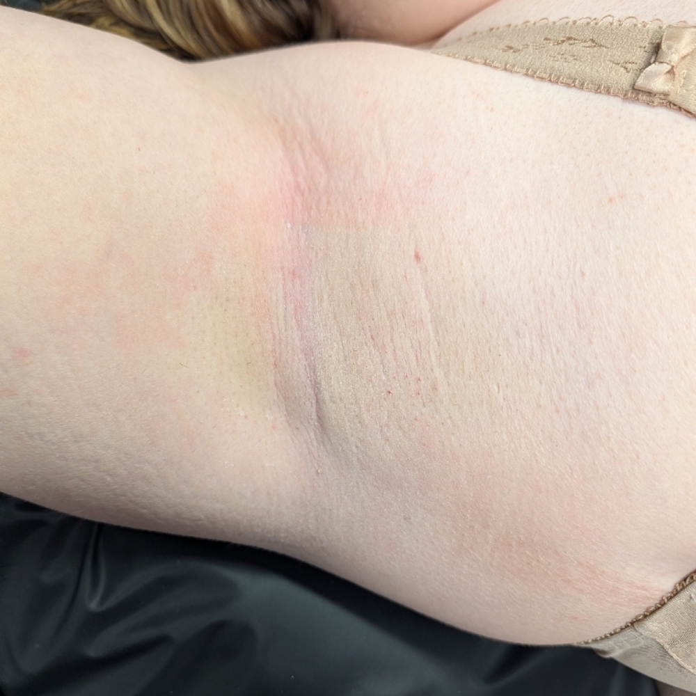 Underarm Wax at Moonlit Esthetics in Minneapolis, MN