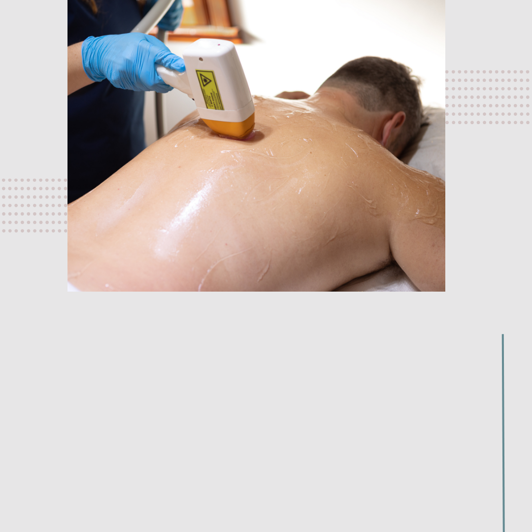 Laser Hair Removal - Full Back
