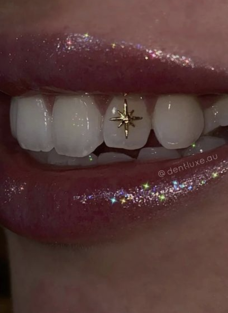 Tooth Gems